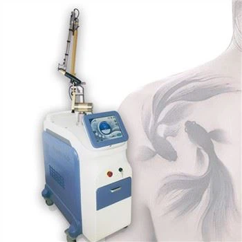 Picoseconds có thể xóa hình xăm và đốm