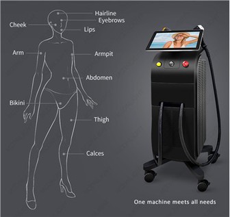 Tẩy lông Titan chính hãng
