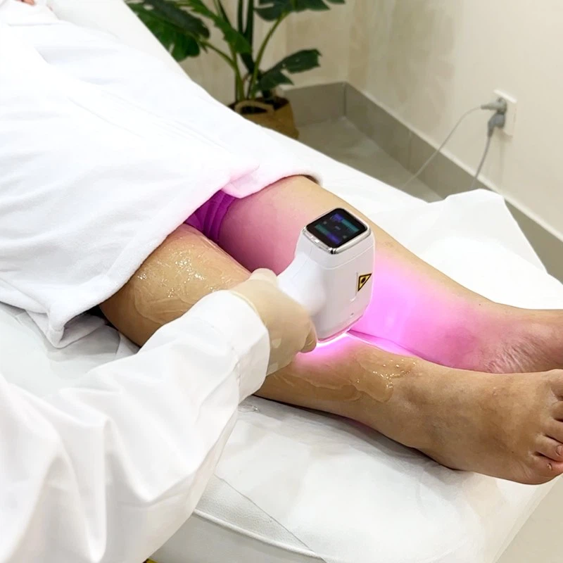 AI-Powered Laser Hair Removal Machines high quality