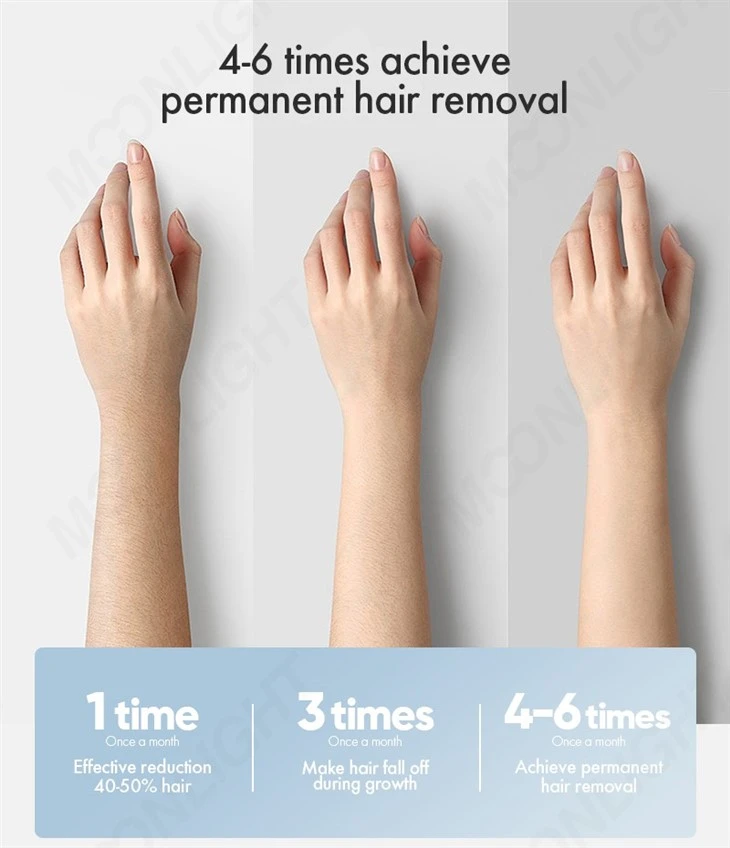 Distributor Want Diode Laser Hair Removal Machine