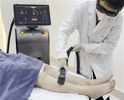 Máy tẩy lông bằng laser diode chạy bằng ai